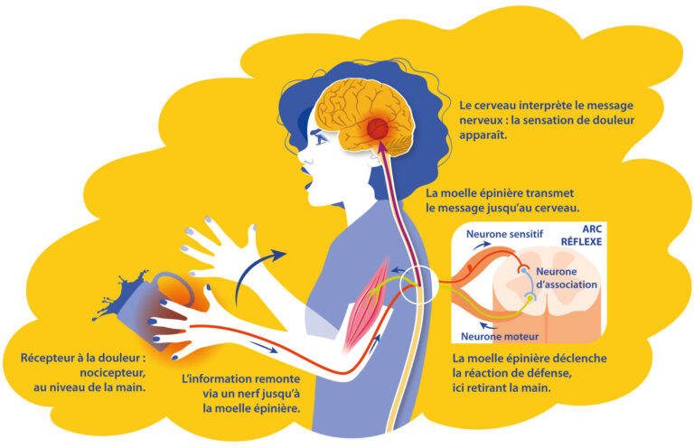 schema trajet douleur